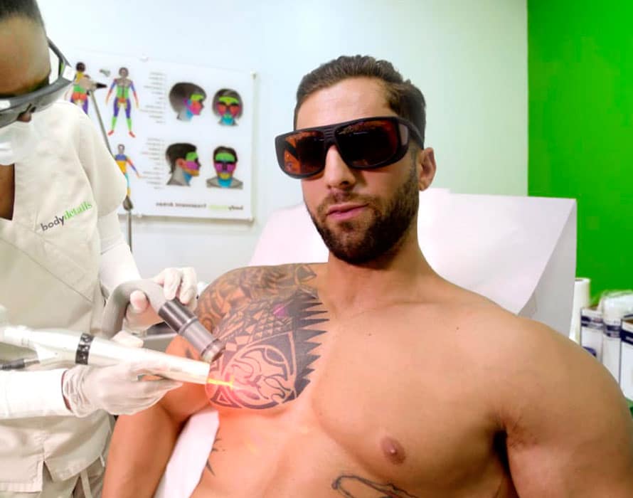 man receiving tattoo removal treatment