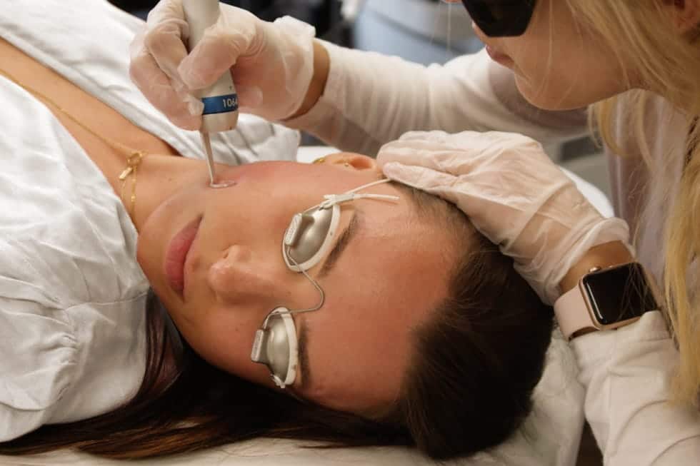 clinician giving woman a laser skin tightening treatment