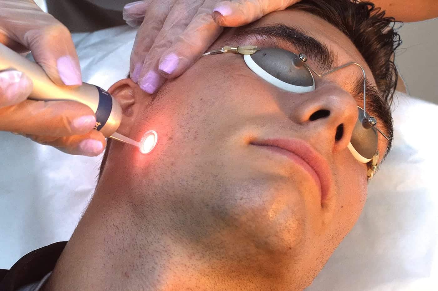 man receiving laser skin rejuvenation treatment on his face